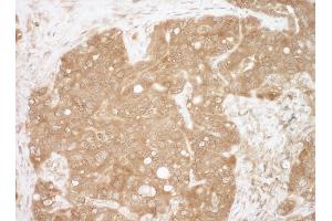 Immunohistochemistry (IHC) image for anti-Calcyclin Binding Protein (CACYBP) (AA 200-228) antibody (ABIN7453668)