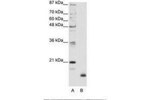 Image no. 1 for anti-Ribosomal Protein L32 (RPL32) (N-Term) antibody (ABIN203010)