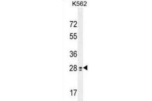 Western Blotting (WB) image for anti-Testis Expressed 13B (TEX13B) antibody (ABIN2995905) (TEX13B Antikörper)