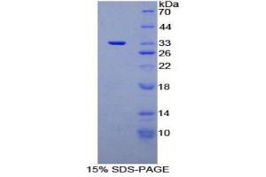 SDS-PAGE (SDS) image for Cardiac Troponin I (TNNI3) (AA 1-211) protein (His tag) (ABIN2122266)