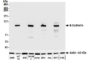 Western Blotting (WB) image for anti-Cadherin 1, Type 1, E-Cadherin (Epithelial) (CDH1) (AA 155-707) antibody (ABIN7454024)
