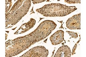 Phospho-RPA32/RPA2 (Ser4/Ser8) Antibody at 1/100 staining Mouse testis tissue by IHC-P. (RPA2 Antikörper  (pSer4, pSer8))