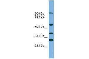 WB Suggested Anti-ASPH Antibody Titration:  0. (Aspartate beta Hydroxylase Antikörper  (N-Term))