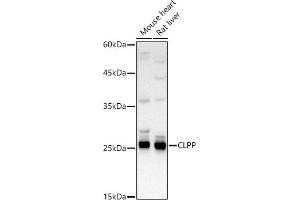Western blot analysis of extracts of various cell lines, using CLPP Rabbit pAb antibody (ABIN6131294, ABIN6138740, ABIN6138741 and ABIN6224901) at 1:500 dilution. (CLPP Antikörper  (AA 1-277))