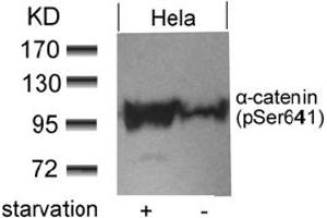 Image no. 1 for anti-Catenin (Cadherin-Associated Protein), alpha 1, 102kDa (CTNNA1) (pSer641) antibody (ABIN401554) (CTNNA1 Antikörper  (pSer641))