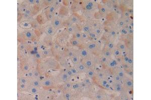 Used in DAB staining on fromalin fixed paraffin- embedded Kidney tissue (MTERF Antikörper  (AA 1-191))