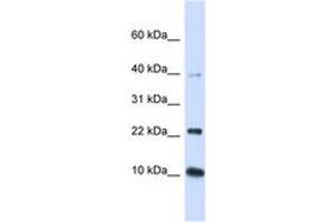 Image no. 1 for anti-Ubiquitin-Conjugating Enzyme E2D 2 (UBE2D2) (N-Term) antibody (ABIN6743143) (UBE2D2 Antikörper  (N-Term))