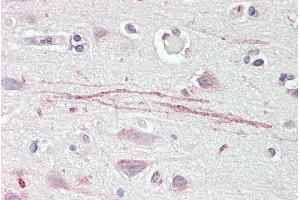 ABIN2613387 (5µg/ml) staining of paraffin embedded Human Cortex. (ASIC1 Antikörper  (C-Term))