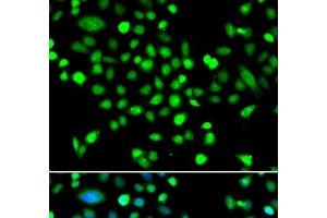 Immunofluorescence analysis of MCF-7 cells using PRKAG1 Polyclonal Antibody (PRKAG1 Antikörper)