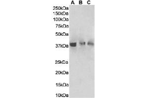 Western Blot using anti-HVEM antibody HMHV-1B18. (Rekombinanter HVEM Antikörper)