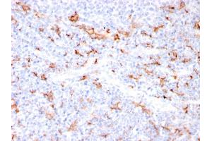 Formalin-fixed, paraffin-embedded human Tonsil stained with S100A8/A9 Complex Recombinant Rabbit Monoclonal Antibody (MAC3157R). (Rekombinanter S100A8 Antikörper)