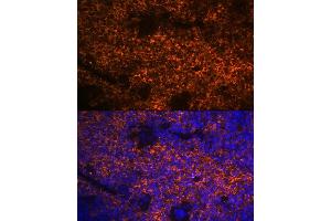 Immunofluorescence analysis of mouse spleen using Hemoglobin subunit alpha (HB) (HB) Rabbit mAb (ABIN7267608) at dilution of 1:100 (40x lens). (HBA1 Antikörper)