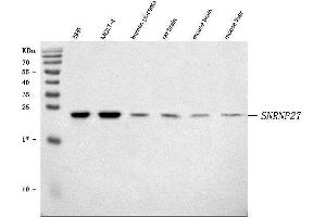 Western blot analysis of SNRNP27 using anti-SNRNP27 antibody (ABIN7599614). (SNRNP27 Antikörper  (AA 100-155))