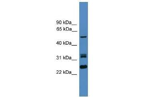 LRRFIP2 antibody used at 0.