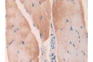 DAB staining on IHC-P; Samples: Mouse Skeletal muscle Tissue (LGMN Antikörper  (AA 18-435))