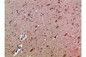Immunohistochemical analysis of paraffin-embedded human-brain, antibody was diluted at 1:200 (CXCL12 Antikörper  (AA 31-80))