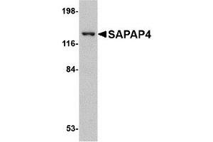 Western Blotting (WB) image for anti-Discs, Large (Drosophila) Homolog-Associated Protein 4 (DLGAP4) (Middle Region) antibody (ABIN1031078) (DLGAP4 Antikörper  (Middle Region))