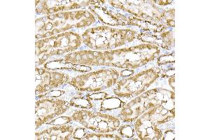 Immunohistochemistry (IHC) image for anti-Sterol Regulatory Element Binding Transcription Factor 2 (SREBF2) (AA 1-220) antibody (ABIN6148430)