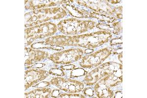 Immunohistochemistry of paraffin-embedded mouse spinal cord using SREBP2 Rabbit pAb (ABIN6128781, ABIN6148430, ABIN6148432 and ABIN6216892) at dilution of 1:50 (40x lens).