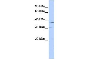 Western Blotting (WB) image for anti-Nuclear Receptor Subfamily 1, Group I, Member 3 (NR1I3) antibody (ABIN2458945) (NR1I3 Antikörper)