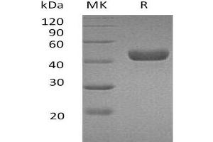 Western Blotting (WB) image for Carbonic Anhydrase 14 (CAR14) (Active) protein (His tag) (ABIN7320478)