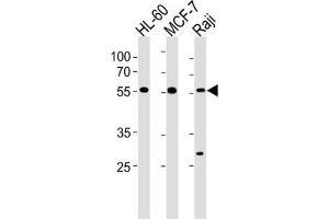 Western Blotting (WB) image for anti-Chromosome 16 Open Reading Frame 71 (C16ORF71) antibody (ABIN3004592) (C16ORF71 Antikörper)