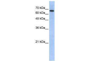 WB Suggested Anti-ARHGAP28 Antibody Titration: 0. (ARHGAP28 Antikörper  (N-Term))