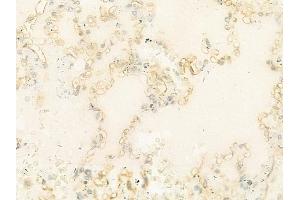 ABIN6263246 and ABIN6274024 at 1/100 staining human normal lung tissue by IHC-P. (MICA Antikörper  (C-Term))