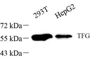 Western blot analysis of TFG (ABIN7076022),at dilution of 1: 1000