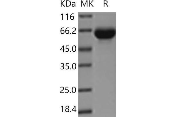 KIRREL3 Protein (His tag)