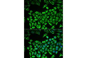 Immunofluorescence analysis of A549 cells using HAS3 antibody. (HAS3 Antikörper)