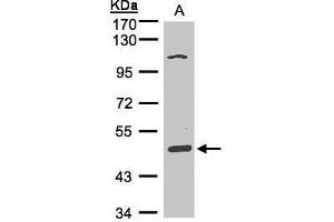 WB Image Sample(30 μg of whole cell lysate) A:Hep G2, 7. (SCARA3 Antikörper)