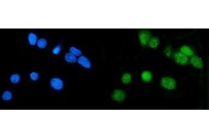 IF analysis of LSM7 using anti-LSM7 antibody (ABIN7598937).