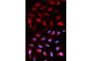 Immunofluorescence analysis of U2OS cells using PPARD antibody (ABIN5973301). (PPARD Antikörper)