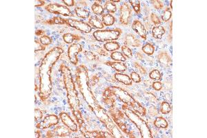 Immunohistochemistry of paraffin-embedded rat kidney using CYB5A antibody (ABIN6130832, ABIN6139296, ABIN6139297 and ABIN6221049) at dilution of 1:100 (40x lens).