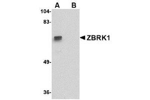 Image no. 1 for anti-Zinc Finger Protein 350 (ZNF350) (C-Term) antibody (ABIN342727) (ZNF350 Antikörper  (C-Term))