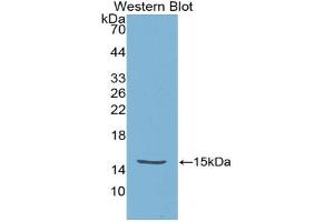 Figure. (High Temperature Requirement Factor A1 (AA 304-442) Antikörper)