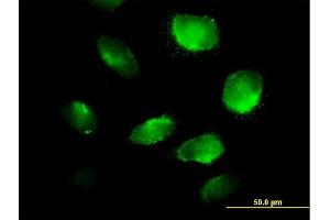 Immunofluorescence of purified MaxPab antibody to TXNDC5 on HeLa cell. (TXNDC5 Antikörper  (AA 1-360))