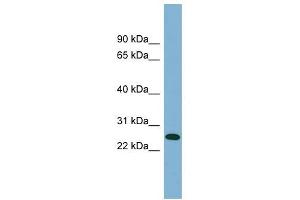 ITGB1BP3 antibody used at 1 ug/ml to detect target protein. (ITGB1BP3 Antikörper  (Middle Region))
