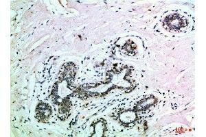 Immunohistochemical analysis of paraffin-embedded Human-breast, antibody was diluted at 1:100 (EPH Receptor B3 Antikörper  (AA 650-700))