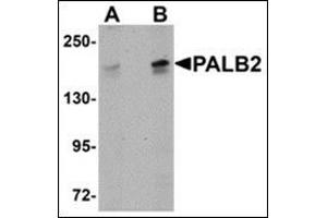 Western blot analysis of PALB2 in SK-N-SH cell lysate with this product at (A) 1 and (B) 2 μg/ml. (PALB2 Antikörper  (C-Term))