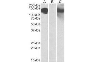 HEK293 lysate (10µg protein in RIPA buffer) overexpressing Human CDH11 with C-terminal MYC tag probed with AP21503PU-N (1µg/ml) in Lane A and probed with anti-MYC Tag (1/1000) in lane C. (OB Cadherin Antikörper  (Internal Region))