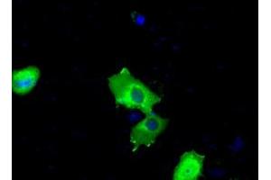 Image no. 7 for anti-Bruton Agammaglobulinemia tyrosine Kinase (BTK) antibody (ABIN1496976) (BTK Antikörper)