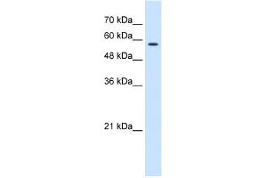 WB Suggested Anti-CCT8 Antibody Titration:  0. (CCT8 Antikörper  (C-Term))