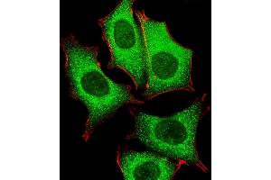 Fluorescent image of MCF-7 cells stained with GLD2 Antibody (N-term) (ABIN651284 and ABIN2840170). (PAPD4 Antikörper  (N-Term))