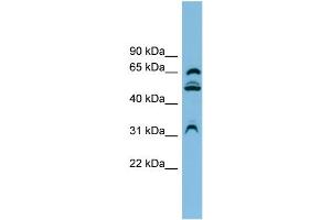 WB Suggested Anti-WDR1 Antibody Titration:  0. (WDR1 Antikörper  (N-Term))