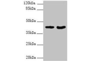 Western blot All lanes: DMKN antibody at 6 μg/mL Lane 1: Mouse kidney tissue Lane 2: Mouse liver tissue Secondary Goat polyclonal to rabbit IgG at 1/10000 dilution Predicted band size: 48, 16, 37, 46, 39, 42, 36, 21, 19, 17, 15, 10, 47 kDa Observed band size: 42 kDa (Dermokine Antikörper  (AA 1-137))