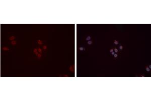 ABIN6277358 staining Hela cells by IF/ICC. (DDB1 Antikörper  (C-Term))