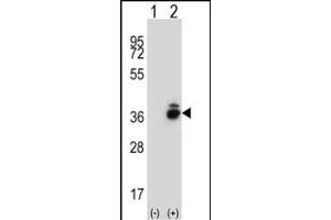 Western Blotting (WB) image for anti-Corticotropin Releasing Hormone Binding Protein (CRHBP) (AA 7-36), (N-Term) antibody (ABIN656818)