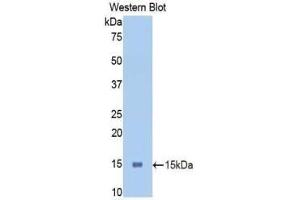 Western blot analysis of the recombinant protein. (PIGR Antikörper  (AA 463-563))
